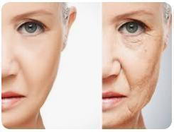 Before-and-after illustration showing ways to prevent ‘Ozempic Face’ while using GLP-1 weight loss medication.