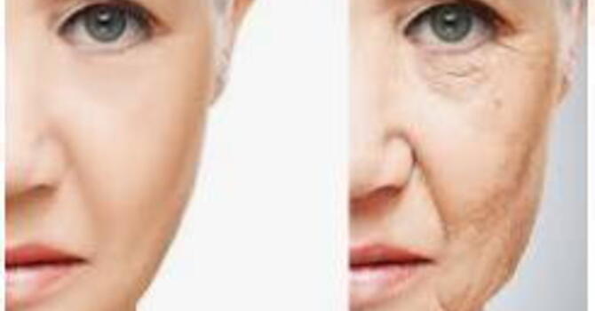 Avoid "Ozempic Face" During Weight Loss image